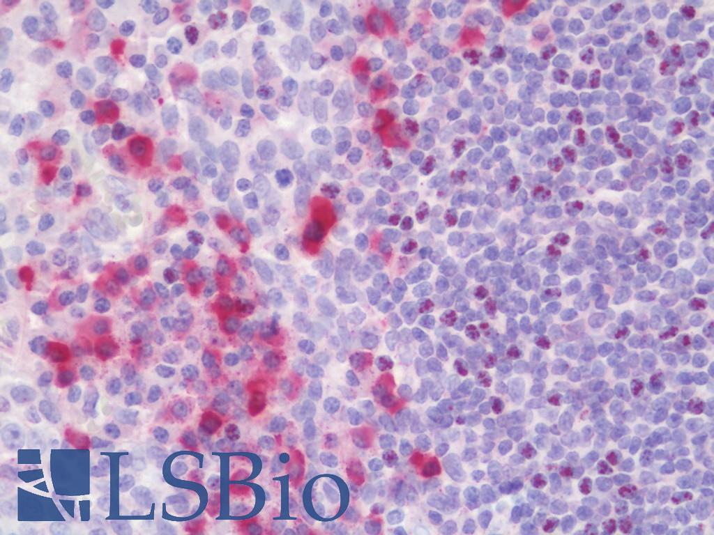 HLA-A2 Antibody - Anti-HLA-A2 antibody IHC staining of human tonsil. Immunohistochemistry of formalin-fixed, paraffin-embedded tissue after heat-induced antigen retrieval. This image was taken for the unmodified form of this product. Other forms have not been tested.