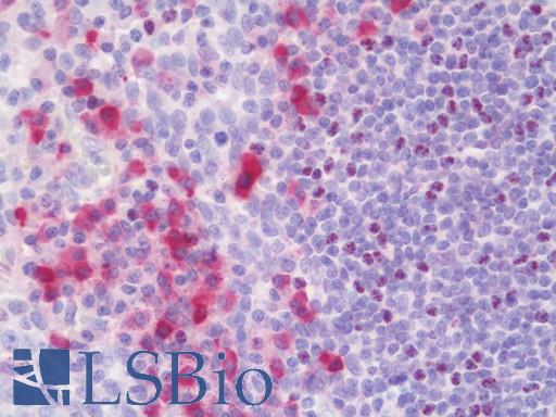 HLA-A2 Antibody - Anti-HLA-A2 antibody IHC staining of human tonsil. Immunohistochemistry of formalin-fixed, paraffin-embedded tissue after heat-induced antigen retrieval. This image was taken for the unmodified form of this product. Other forms have not been tested.