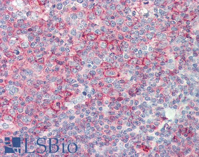 HLA-B Antibody - Anti-HLA-B antibody IHC staining of human tonsil. Immunohistochemistry of formalin-fixed, paraffin-embedded tissue after heat-induced antigen retrieval. Antibody concentration 20 ug/ml. This image was taken for the unconjugated form of this product. Other forms have not been tested.