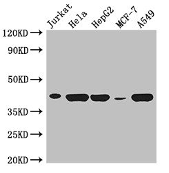HLA-B Antibody - Western Blot Positive WB detected in: Jurkat whole cell lysate, Hela whole cell lysate, HepG2 whole cell lysate, MCF-7 whole cell lysate, A549 whole cell lysate All lanes: HLA-B antibody at 3µg/ml Secondary Goat polyclonal to rabbit IgG at 1/50000 dilution Predicted band size: 41 kDa Observed band size: 41 kDa