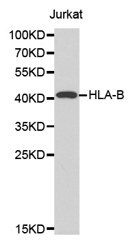 HLA-B Antibody - Western blot analysis of extracts of Jurkat cells.