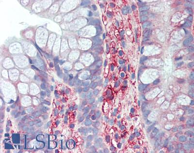 HLA-B Antibody - Human Small Intestine: Formalin-Fixed, Paraffin-Embedded (FFPE)