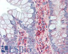 HLA-B Antibody - Human Small Intestine: Formalin-Fixed, Paraffin-Embedded (FFPE)