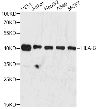 HLA-B Antibody - Western blot analysis of extracts of various cell lines, using HLA-B antibody at 1:3000 dilution. The secondary antibody used was an HRP Goat Anti-Rabbit IgG (H+L) at 1:10000 dilution. Lysates were loaded 25ug per lane and 3% nonfat dry milk in TBST was used for blocking. An ECL Kit was used for detection and the exposure time was 30s.