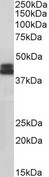 HLA-B Antibody - HLA-B antibody (0.1µg/ml) staining of Jurkat lysate (35µg protein in RIPA buffer). Detected by chemiluminescence.