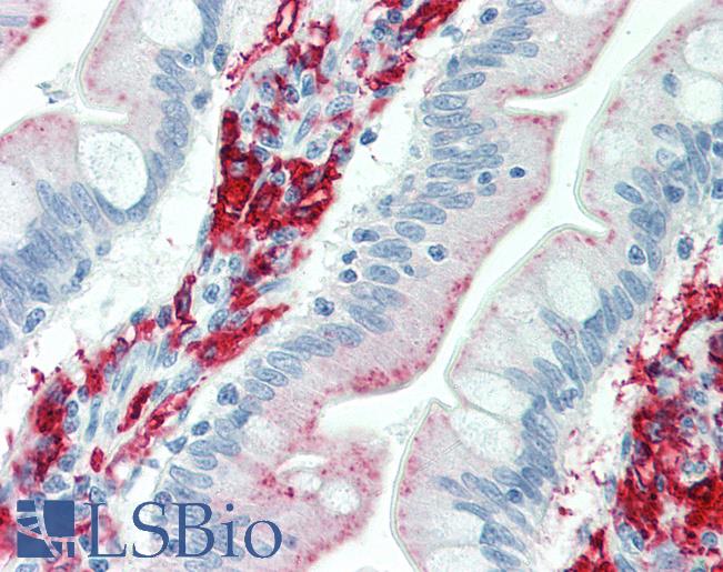 HLA-DP+DQ+DR Antibody - Anti-HLA-DP+DQ+DR antibody IHC staining of human small intestine. Immunohistochemistry of formalin-fixed, paraffin-embedded tissue after heat-induced antigen retrieval. Antibody concentration 10 ug/ml.