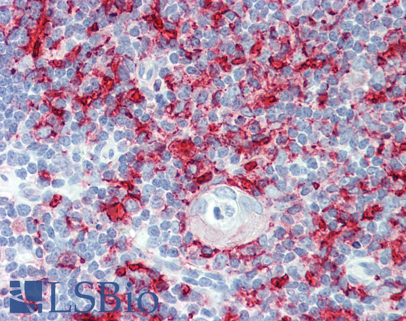 HLA-DP+DQ+DR Antibody - Anti-HLA-DP+DQ+DR antibody IHC staining of human thymus. Immunohistochemistry of formalin-fixed, paraffin-embedded tissue after heat-induced antigen retrieval.