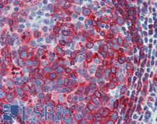 HLA-DP/DR Antibody - Human Small Intestine, MALT: Formalin-Fixed, Paraffin-Embedded (FFPE)