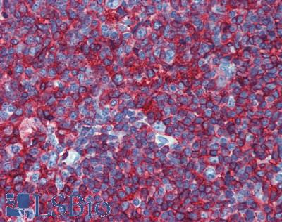HLA-DP/DR Antibody - Human Tonsil: Formalin-Fixed, Paraffin-Embedded (FFPE)