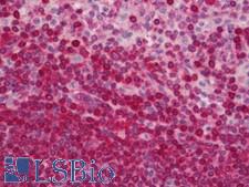 HLA-DPB1 Antibody - Human Spleen: Formalin-Fixed, Paraffin-Embedded (FFPE)