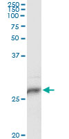 HLA-DPB1 Antibody - Immunoprecipitation of HLA-DPB1 transfected lysate using anti-HLA-DPB1 monoclonal antibody and Protein A Magnetic Bead and immunoblotted with HLA-DPB1 monoclonal antibody.