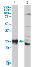 HLA-DPB1 Antibody - Western blot of HLA-DPB1 expression in transfected 293T cell line by HLA-DPB1 monoclonal antibody (M01), clone 6C6.