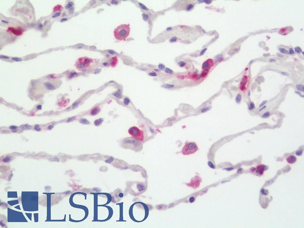 HLA-DPB1 Antibody - Human Lung: Formalin-Fixed, Paraffin-Embedded (FFPE).  This image was taken for the unconjugated form of this product. Other forms have not been tested.