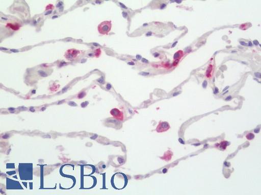 HLA-DPB1 Antibody - Human Lung: Formalin-Fixed, Paraffin-Embedded (FFPE).  This image was taken for the unconjugated form of this product. Other forms have not been tested.