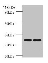 HLA-DPB1 Antibody - Western blot All lanes: HLA class II histocompatibility antigen, DP beta 1 chain antibody at 2µg/ml Lane 1: sw1990 whole cell lysate Lane 2: HGC-27 whole cell lysate Secondary Goat polyclonal to rabbit IgG at 1/10000 dilution Predicted band size: 26 kDa Observed band size: 26 kDa