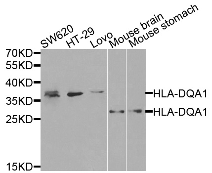 HLA-DQA1 Antibody - Western blot analysis of extracts of various cells.