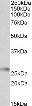 HLA-DQA2 Antibody - Goat Anti-HLA-DQA2 Antibody (0.3µg/ml) staining of Human Bone Marrow lysate (35µg protein in RIPA buffer). Detected by chemiluminescencence.