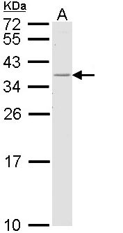 HLA-DR Antibody - Sample (30 ug of whole cell lysate). A: H1299. 12% SDS PAGE. HLA-DRB1 antibody diluted at 1:1000. 