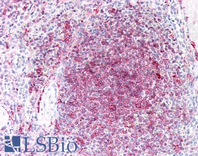HLA-DRB1 Antibody - Human Spleen: Formalin-Fixed, Paraffin-Embedded (FFPE), at a dilution of 1:50.