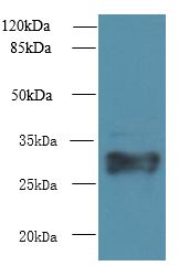 HLA-DRB4 Antibody - Western blot. All lanes: HLA-DRB4 antibody at 2 ug/ml+ Raji whole cell lysate Goat polyclonal to rabbit at 1:10000 dilution. Predicted band size: 30 kDa. Observed band size: 30 kDa.