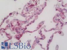 HLA-E Antibody - Human Lung: Formalin-Fixed, Paraffin-Embedded (FFPE)