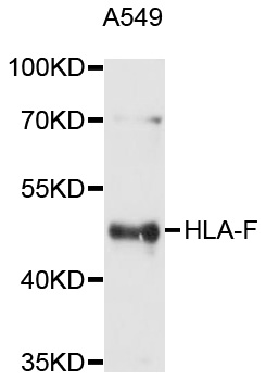 HLA-F Antibody - Western blot analysis of extracts of A-549 cells, using HLA-F antibody at 1:1000 dilution. The secondary antibody used was an HRP Goat Anti-Rabbit IgG (H+L) at 1:10000 dilution. Lysates were loaded 25ug per lane and 3% nonfat dry milk in TBST was used for blocking. An ECL Kit was used for detection and the exposure time was 1s.