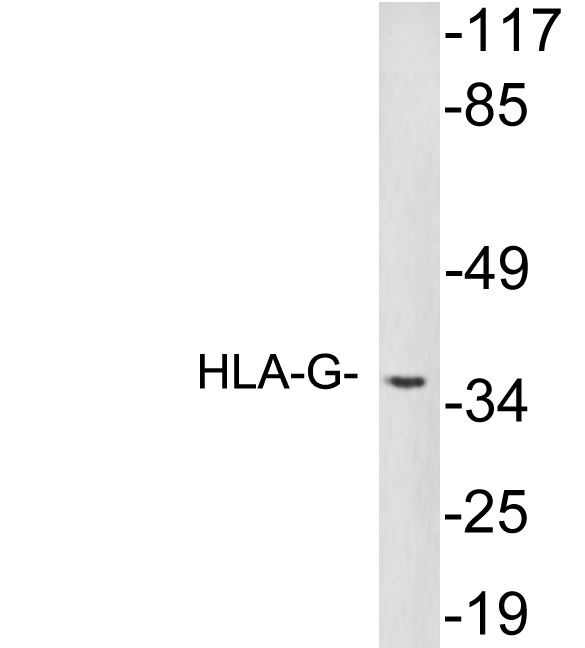 HLA-G Antibody - Western blot analysis of lysates from HeLa cells, using HLA-G antibody.