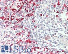 HMBS / PBGD Antibody - Human Spleen: Formalin-Fixed, Paraffin-Embedded (FFPE)