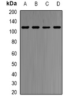 HMG-CoA Reductase / HMGCR Antibody - Western blot analysis of HMGCR expression in HepG2 (A); HeLa (B); mouse spleen (C); rat liver (D) whole cell lysates.