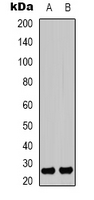 HMG1 / HMGB1 Antibody - Western blot analysis of HMGB1 (AcK12) expression in NIH3T3 (A); HepG2 UV-treated (B) whole cell lysates.