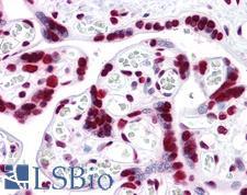 HMG1 / HMGB1 Antibody - Anti-HMGB1 antibody IHC of human placenta. Immunohistochemistry of formalin-fixed, paraffin-embedded tissue after heat-induced antigen retrieval. Antibody concentration 5 ug/ml.