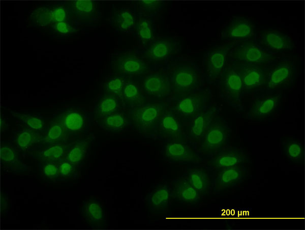 HMG1 / HMGB1 Antibody - Immunofluorescence of monoclonal antibody to HMGB1 on HeLa cell (antibody concentration 10 ug/ml).