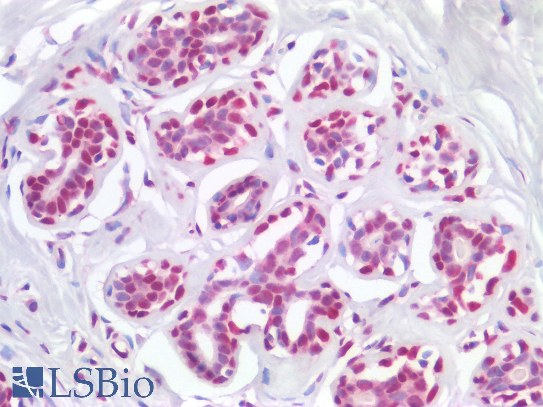 HMG1 / HMGB1 Antibody - Human Breast: Formalin-Fixed, Paraffin-Embedded (FFPE)