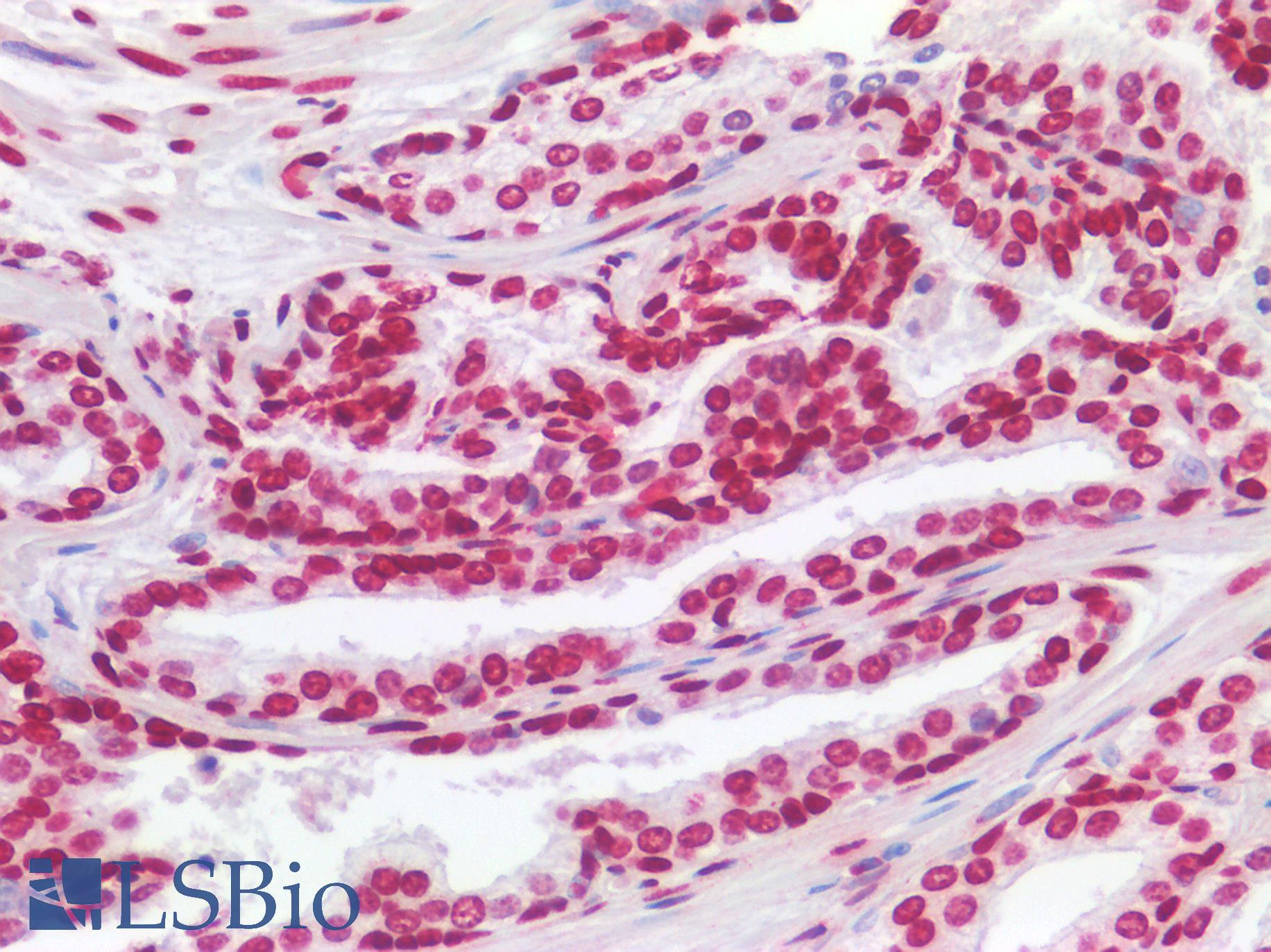 HMG1 / HMGB1 Antibody - Human Prostate: Formalin-Fixed, Paraffin-Embedded (FFPE)