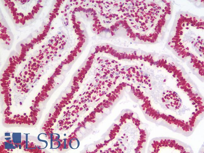 HMG1 / HMGB1 Antibody - Human Small Intestine: Formalin-Fixed, Paraffin-Embedded (FFPE)