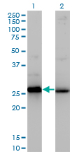 HMG2 / HMGB2 Antibody - Western blot of HMGB2 expression in transfected 293T cell line by HMGB2 monoclonal antibody (M03), clone 3C7.