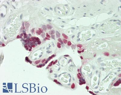 HMGB3 Antibody - Human Placenta: Formalin-Fixed, Paraffin-Embedded (FFPE)