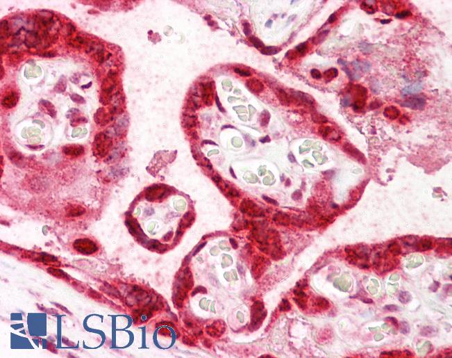 HMGB3 Antibody - Anti-HMGB3 antibody IHC of human placenta. Immunohistochemistry of formalin-fixed, paraffin-embedded tissue after heat-induced antigen retrieval. Antibody concentration 10 ug/ml.