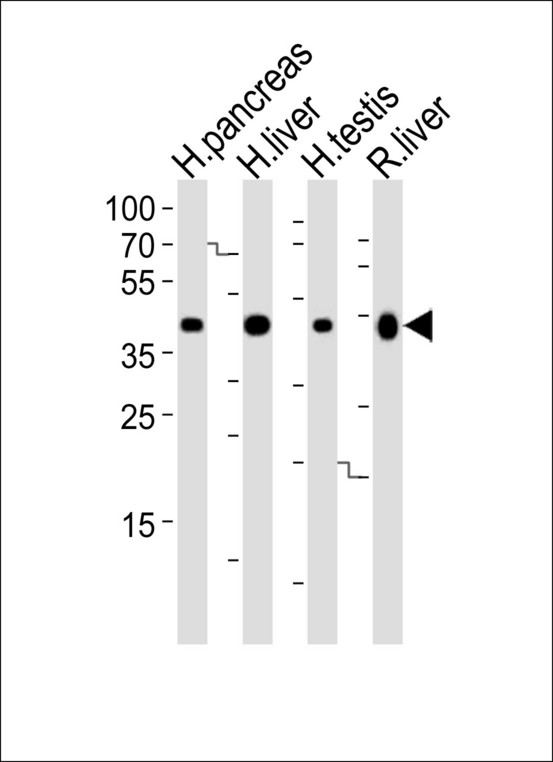 HMGCS2 / HMG-CoA Synthase 2 Antibody - Western blot of lysates from human pancreas, liver, testis and rat liver tissue lysate (from left to right), using HMGCS2 Antibody. Antibody was diluted at 1:1000 at each lane. A goat anti-rabbit IgG H&L (HRP) at 1:10000 dilution was used as the secondary antibody. Lysates at 35ug per lane.