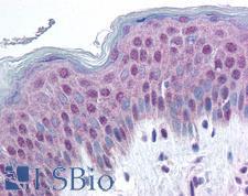 HMGN1 / HMG14 Antibody - Anti-HMGN1 antibody IHC of human skin. Immunohistochemistry of formalin-fixed, paraffin-embedded tissue after heat-induced antigen retrieval. Antibody concentration 20 ug/ml.