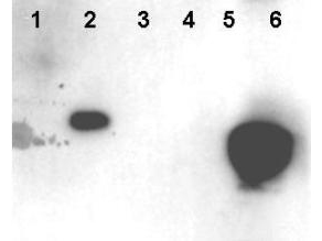 HMGN1 / HMG14 Antibody - Anti-HMNG Antibody - Western Blot. Western blot of Affinity Purified anti-HMNG antibody shows detection of phosphorylated HMGN1 and HMGN2. Recombinant native and mutant HMGN proteins were treated with kinase PKCalpha to specifically phosphorylate S20 and S24 residues. Lanes contain: 1 - HMGN1, non-phosphorylated, 2 - HMGN1, phosphorylated, 3 - HMGN1 delta20E, delta24E, non-phosphorylated, 4 - HMGN1, delta20E, delta24E, phosphorylated, 5 - HMGN2, non-phosphorylated, and 6 - HMGN2, phosphorylated. Molecular weight markers (not shown) confirm the size of each recombinant protein. The primary antibody was diluted 1:1000 for this experiment. The blot was procebetaed using a 5 sec exposure time. Personal Communication, Yuri Postnikov, NIH, CCR, Bethesda, MD.