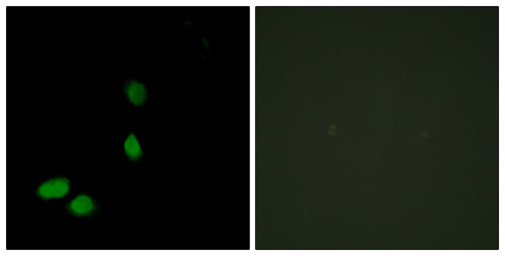 HMGN2 Antibody - Immunofluorescence analysis of HeLa cells, using HMG17 Antibody. The picture on the right is blocked with the synthesized peptide.