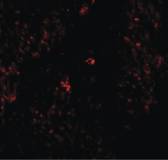 HMMR / CD168 / RHAMM Antibody - Immunofluorescence of RHAMM in human stomach tissue with RHAM antibody at 20 ug/ml.