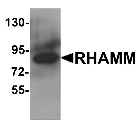 HMMR / CD168 / RHAMM Antibody - Western blot analysis of RHAMM in rat stomach tissue lysate with RHAMM antibody at 1 ug/ml.