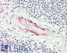 HMOX1 / HO-1 Antibody - Human Spleen, Vessel: Formalin-Fixed, Paraffin-Embedded (FFPE)