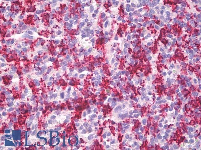 HMOX1 / HO-1 Antibody - Anti-HMOX1 / HO-1 antibody IHC staining of human spleen, macrophages. Immunohistochemistry of formalin-fixed, paraffin-embedded tissue after heat-induced antigen retrieval.  This image was taken for the unconjugated form of this product. Other forms have not been tested.
