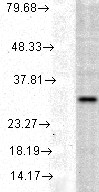 HMOX1 / HO-1 Antibody - HO-1, Human cell line mix.  This image was taken for the unconjugated form of this product. Other forms have not been tested.