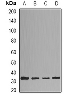 HMT / HNMT Antibody - Western blot analysis of HNMT expression in HepG2 (A); HeLa (B); mouse liver (C); mouse brain (D) whole cell lysates.