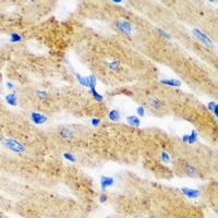 HMT / HNMT Antibody - Immunohistochemical analysis of HNMT staining in mouse heart formalin fixed paraffin embedded tissue section. The section was pre-treated using heat mediated antigen retrieval with sodium citrate buffer (pH 6.0). The section was then incubated with the antibody at room temperature and detected using an HRP conjugated compact polymer system. DAB was used as the chromogen. The section was then counterstained with hematoxylin and mounted with DPX.