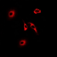 HMT / HNMT Antibody - Immunofluorescent analysis of HNMT staining in U2OS cells. Formalin-fixed cells were permeabilized with 0.1% Triton X-100 in TBS for 5-10 minutes and blocked with 3% BSA-PBS for 30 minutes at room temperature. Cells were probed with the primary antibody in 3% BSA-PBS and incubated overnight at 4 deg C in a humidified chamber. Cells were washed with PBST and incubated with a DyLight 594-conjugated secondary antibody (red) in PBS at room temperature in the dark.